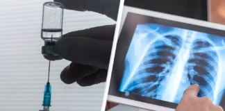 World’s First Lung Cancer Vaccine Begins Clinical Trials in 7 Countries, Including Turkey
