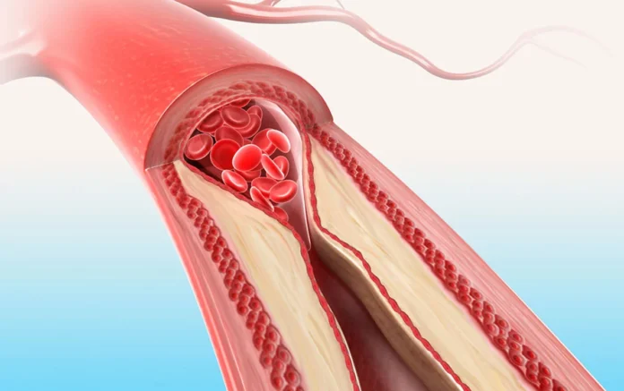 أوعية دموية اصطناعية